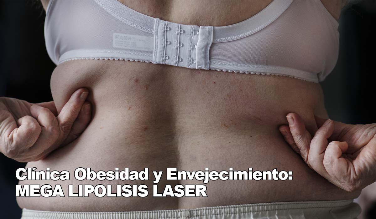 Dr Gabriel Cubillos Clinica Obesidad y Envejecimiento lipolaser